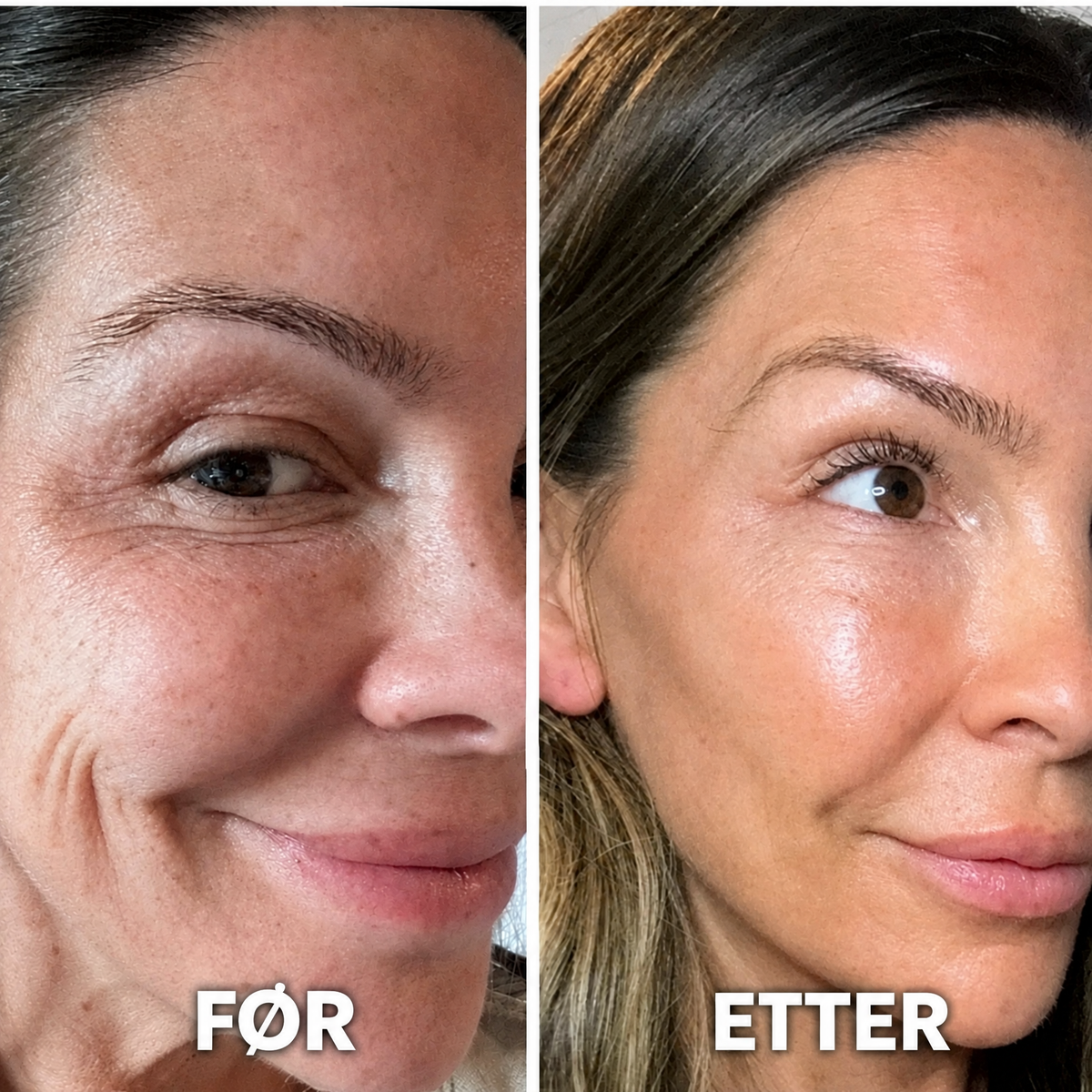 PDRN Collagen Volume Balm – For fine linjer og strålende hud