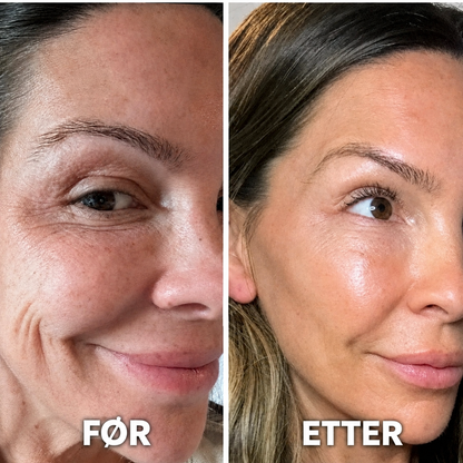 PDRN Collagen Volume Balm – For fine linjer og strålende hud