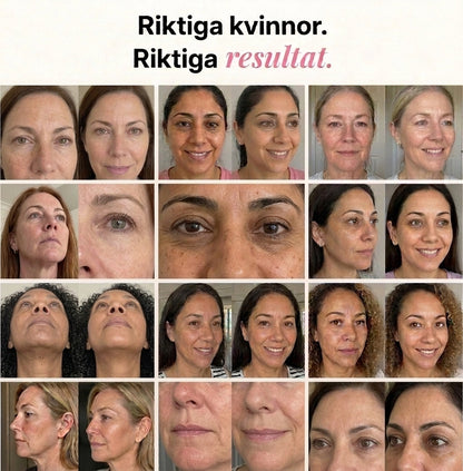 PDRN Collagen Volume Balm – For fine linjer og strålende hud